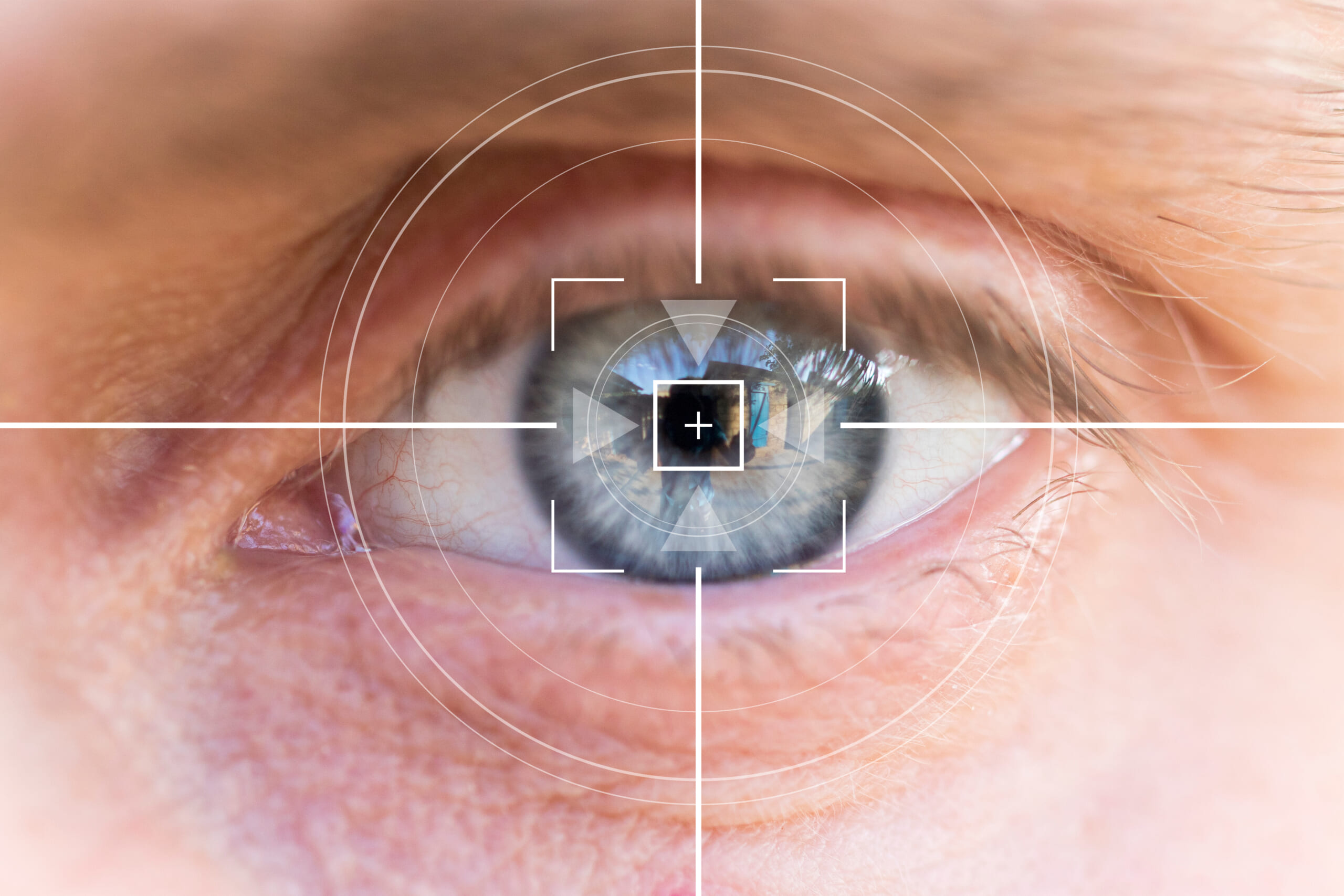 東京でおすすめの眼瞼下垂クリニック｜眼瞼下垂の基礎知識